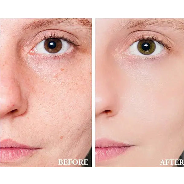 CeraVe Blemish Control Gel – Targeted Treatment for Clearer, Healthier Skin