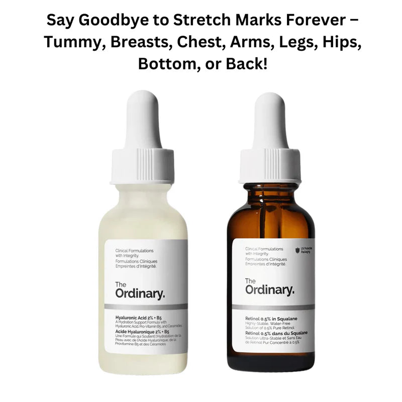 Stretch Marks Gone Forever – Fade Scars from Tummy, Breasts, Hips & More