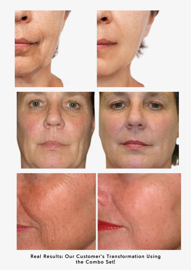 Anti-Aging Combo Set – For Youthful, Radiant, Firm Skin