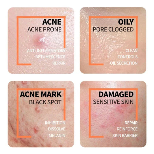 Glow Reset Duo: The Ordinary Niacinamide + Glycolic Acid Power Pair