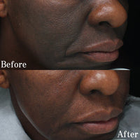 Melasma & Pigmentation Fix Combo – Fade Dark Spots, Brighten Skin!
