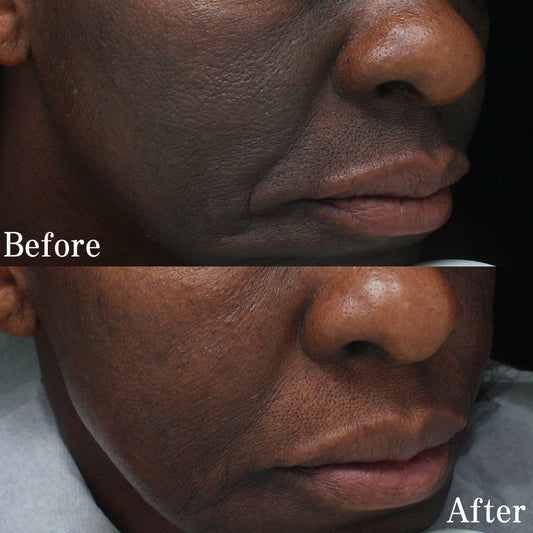 Melasma & Pigmentation Fix Combo – Fade Dark Spots, Brighten Skin!