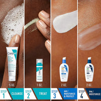 CeraVe Acne Control Set – Complete Skincare Kit for Acne & Breakout-Prone Skin