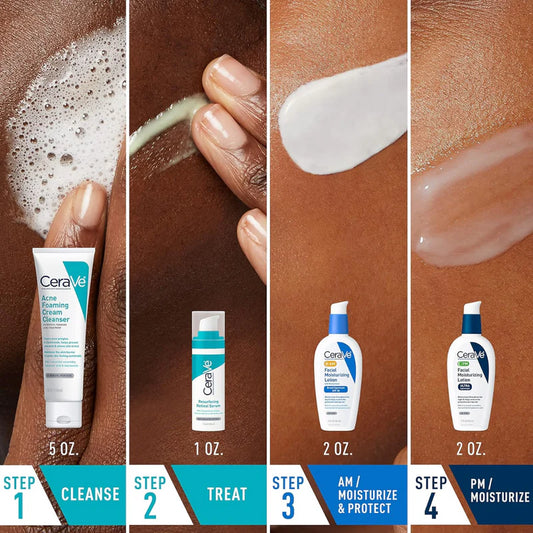 CeraVe Acne Control Set – Complete Skincare Kit for Acne & Breakout-Prone Skin
