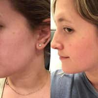 SkinCeuticals C E Ferulic® – Vitamin C Antioxidant Serum with 15% L-Ascorbic Acid 30mL