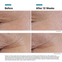 SkinCeuticals P-Tiox – Advanced Anti-Aging Treatment 30mL