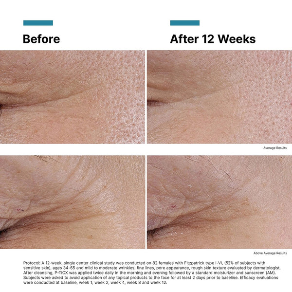 SkinCeuticals P-Tiox – Advanced Anti-Aging Treatment 30mL