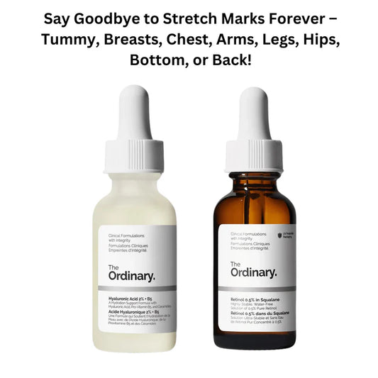 Stretch Marks Gone Forever – Fade Scars from Tummy, Breasts, Hips & More