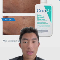 CeraVe Acne Control Cleanser – 2% Salicylic Acid Treatment for Clearer Skin (237ml)