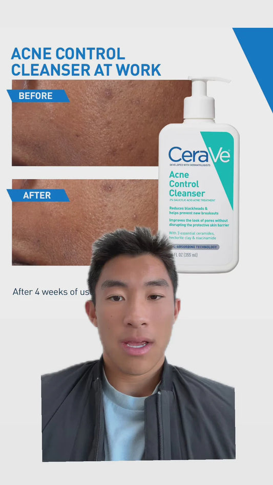 CeraVe Acne Control Cleanser – 2% Salicylic Acid Treatment for Clearer Skin (237ml)