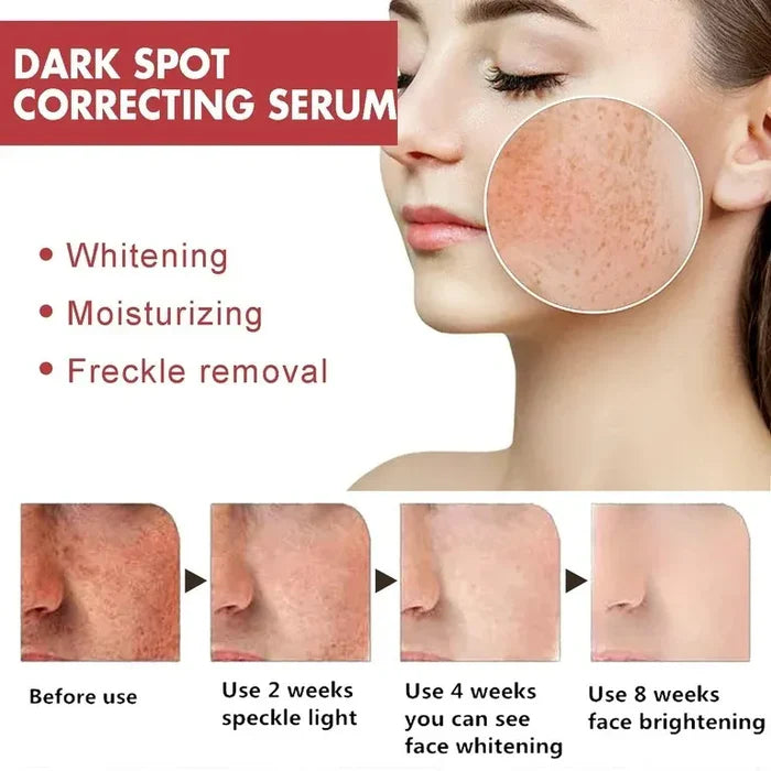 Anua Dark Spot Corrector Serum – Niacinamide 10% + TXA 4% for Even, Radiant Skin