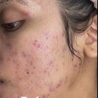 Anua Dark Spot Corrector Serum – Niacinamide 10% + TXA 4% for Even, Radiant Skin