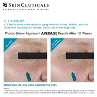 SkinCeuticals C E Ferulic® – Vitamin C Antioxidant Serum with 15% L-Ascorbic Acid 30mL