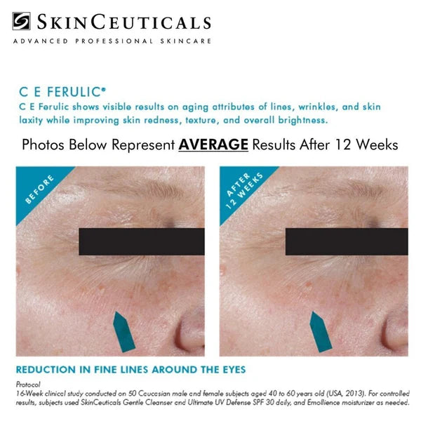 SkinCeuticals C E Ferulic® – Vitamin C Antioxidant Serum with 15% L-Ascorbic Acid 30mL