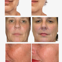 Anti-Aging Combo Set – For Youthful, Radiant, Firm Skin