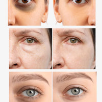 Eye Rescue Combo – Banish Dark Circles, Puffiness & Dullness