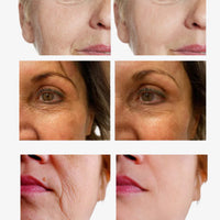 Youthful Skin Combo Set – Smooth Fine Lines & Restore Radiance